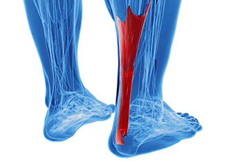 achilles tendon treatment in the Miami-Dade County, FL: Miami (Hialeah, Miami Gardens, Miami Beach, Kendall, Doral, North Miami, Fontainebleau, Tamiami, Westchester, Coral Gables, Hialeah Gardens, Sweetwater, Gladeview) areas